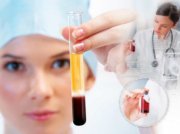 PRP (Platelet Rich Plazma) TERAPİ